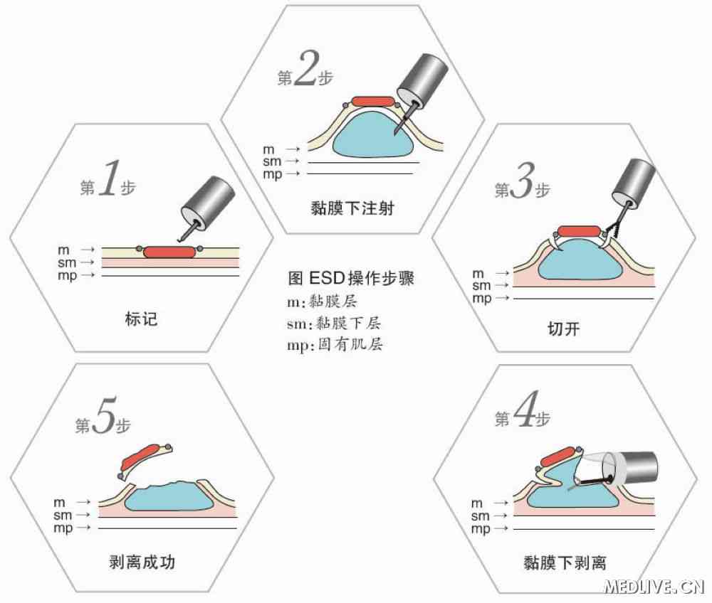 明日方舟年技能 年属性|威尼斯wns8885566